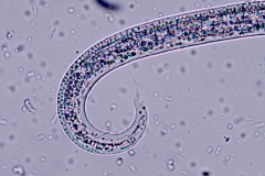 A. vasorum -  detail chvosta larvy prvého štádia