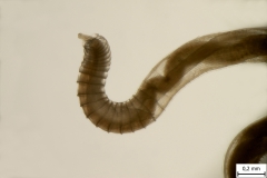 A. vasorum - detail hlavovej časti samca
