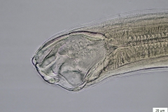 Ancylostoma sp. - detail ústnej kapsuly dospelého jedinca (trvalý mikropreparát)