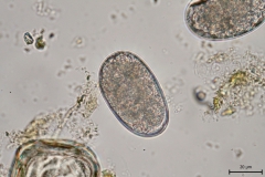 č. Trichostrongylidae - vajíčko (detail)