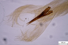 Haemonchus contortus - chvost samca (trvalý mikropreparát)
