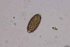 Capillaria spp. - vajíčko