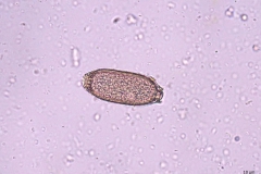 Capillaria spp. - vajíčko