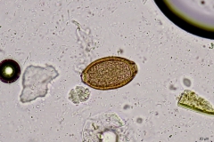 Capillaria spp. - vajíčko