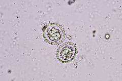 Ch. infundibulum - vajíčka