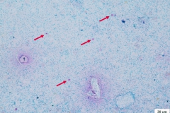Cryptosporidium spp. - oocysty (farbenie podľa Kinyona - šípka)