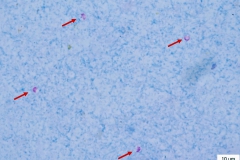 Cryptosporidium spp. - oocysty (farbenie podľa Kinyona - šípka) - detail