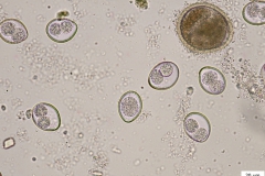 pes - oocysty C. canis (veľká) s vajíčkom škrkavky Toxocara canis (hnedé)