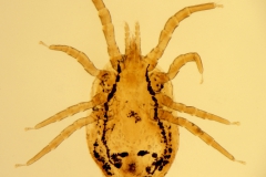 D. gallinae - dospelec (trvalý mikropreparát)
