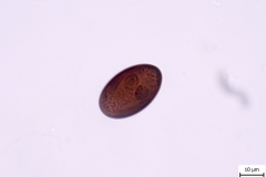 D. dendriticum - vajíčko
