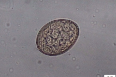 D. latum - vajíčko