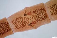 D. caninum - nezrelý článok