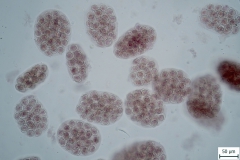 D. caninum - vajíčka v kokónoch