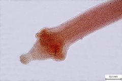 D. caninum-scolex