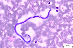 Dirofilaria spp. - detail mikrofilárie vo farbenom krvnom nátere