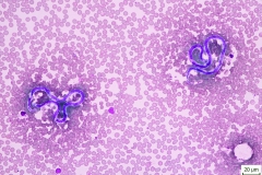 Dirofilaria spp. - mikrofilárie vo farbenom krvnom nátere