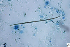 Dirofilaria spp. - nález pri vyšetrení Knottovým testom
