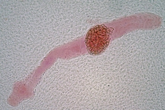 E. granulosus - adult
