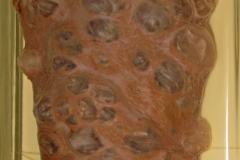 E. multilocularis - alveococcus v MH