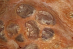 E. multilocularis - alveococcus v MH - detail