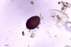 E. leuckarti - oovysta