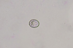 Eimeria spp. - nevysporulovaná oocysta