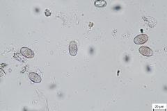 Eimeria spp. - oocysty