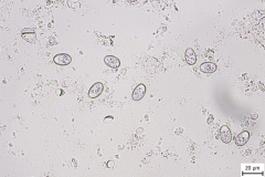 Eimeria spp. - hovädzí dobytok