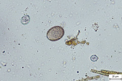 E. intricata (v strede) a oocysty Eimeria spp. - ovca