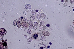 Eimeria sp. - nevysporulované oocysty rôznych druhov