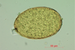 F. hepatica - vajíčko