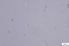 G. duodenalis - cysty