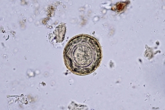 H. diminuta - vajíčko