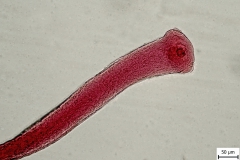 H. diminuta - scolex (trvalý mikropreparát)