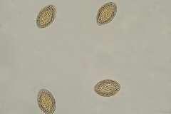 M. hirudinaceus - vajíčka (trvalý mikropreparát)