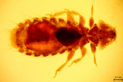 M. galinae - dospelec (trvalý mikropreparát)