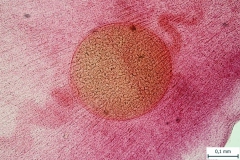 M. lineatus - zrelý článok (detail parauterínného orgánu)