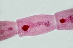 M. lineatus - nezrelý článok (vajíčka  v maternici mimo parauterínného orgánu)