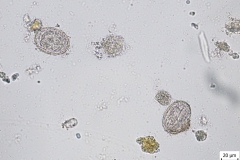 Metastrongylus spp. - vajíčka