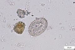 Metastrongylus spp. - vajíčko (detail)