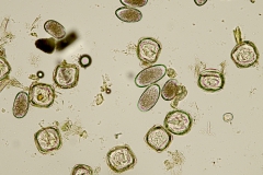 Moniezia spp. - vajíčka nepravidelného tvaru spolu s vajíčkami č. Trichostrongylidae (oválne) (detail)