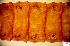 Moniezia expanza - články (farbený mikropreparát)