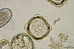 Moniezia spp. - vajíčko (detail)