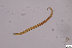 M. capillaris - larva prvého štádia (ofarbená Lugolovým roztokom)