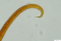 M. capillaris - larva prvého štádia (chvost - detail)