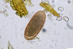 Nematodirus battus  - vajíčko