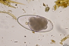 Nematodirus spp. - vajíčko