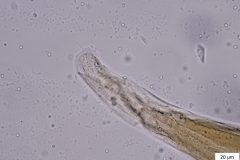 Nematodirus spp. - chvost samice (trvalý mikropreparát)