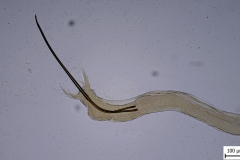 Nematodirus  spp. - chvost samca (trvalý mikropreparát)