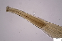 Oesophagostomum sp. - hlavová časť (trvalý mikropreparát)